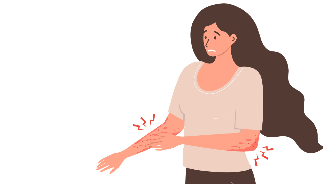 Homeopatia para os Problemas de Pele